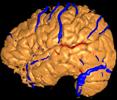 brain